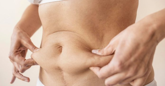 Como perder gordura abdominal? Saiba no que focar