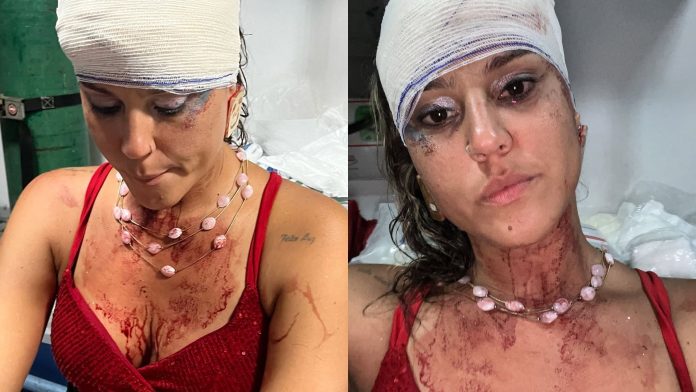Mulher alega agressão policial em bloco carnavalesco de...