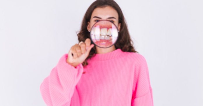 Retra&ccedil;&atilde;o gengival: o que &eacute; e como